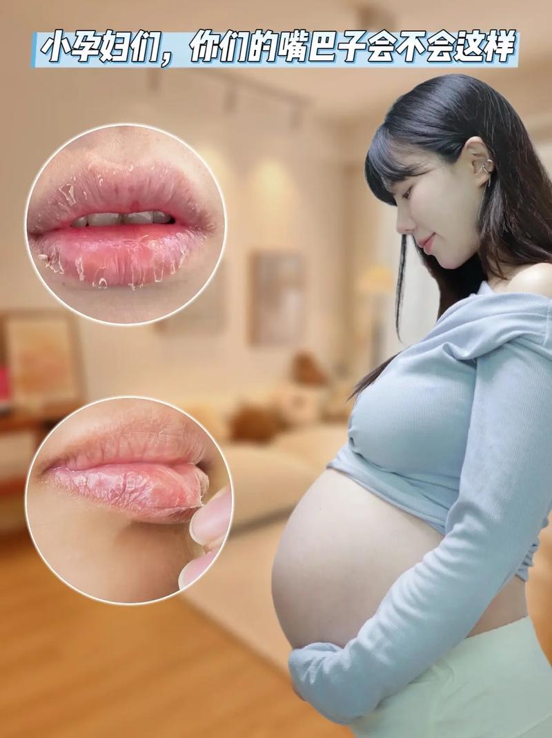 试管代怀助孕初期嘴巴淡口水多